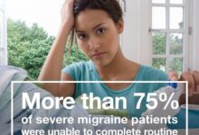 Not flaky i have migraines