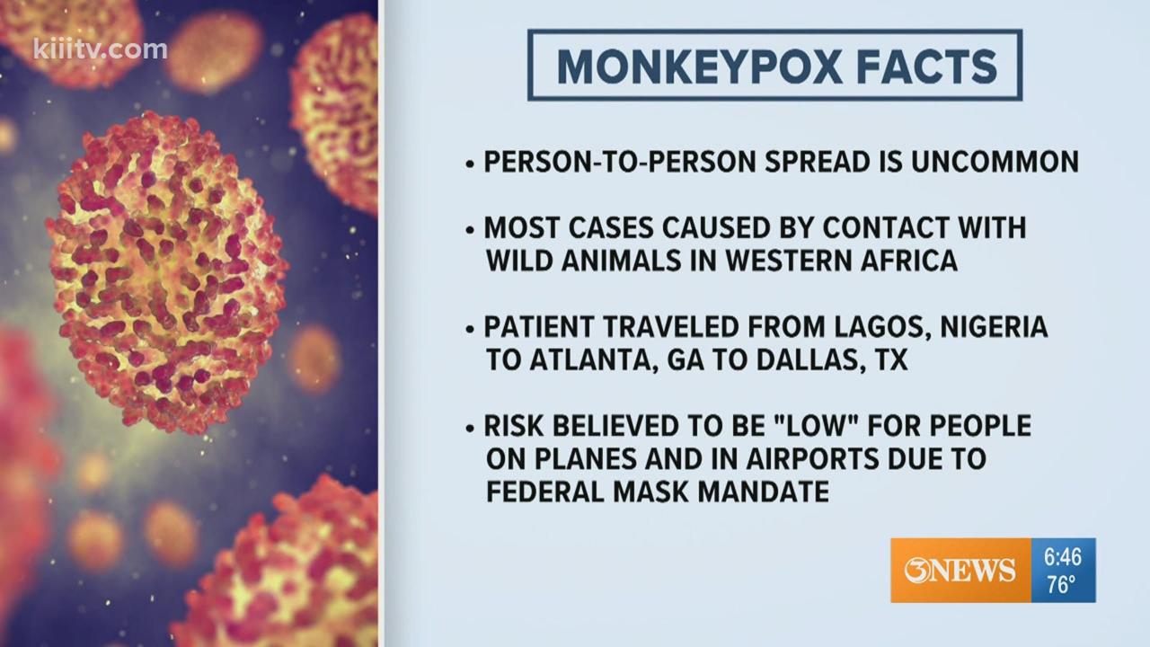 Monkeypox treatment options what to know right now