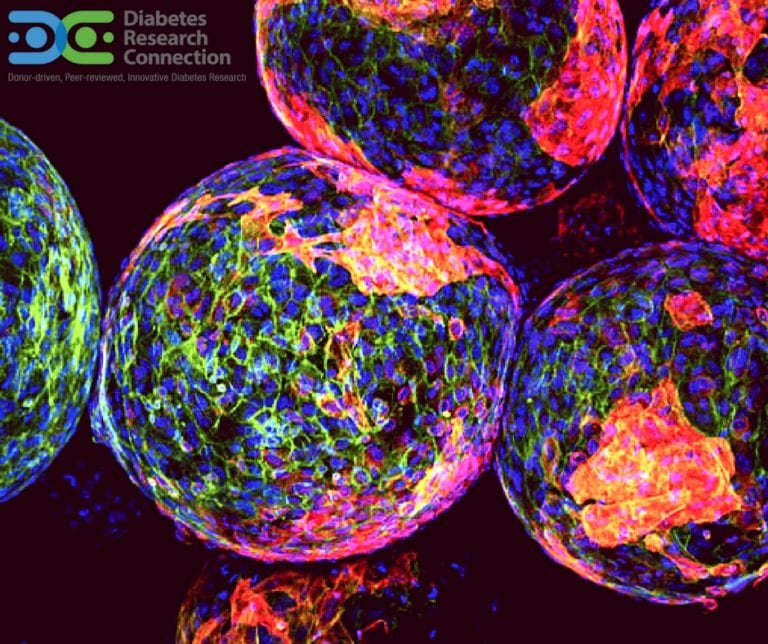Beta cells diabetes what