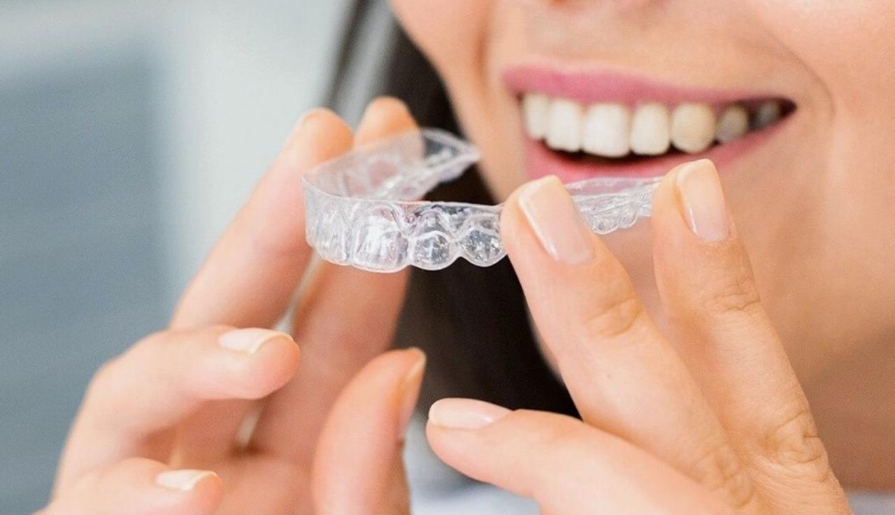How long does invisalign take to work