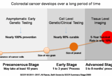 Detecting colon cancer earlier treating later