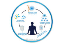 Car t cancer treatment