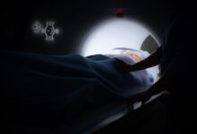 Are cannabis abuse and accelerated brain aging linked