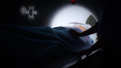 Are cannabis abuse and accelerated brain aging linked