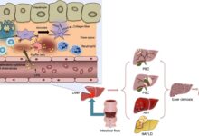 Gut bacteria liver damage