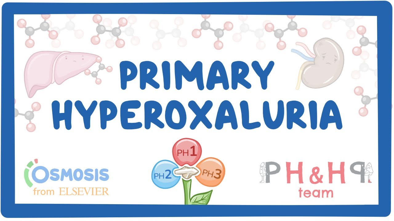 What to know about primary hyperoxaluria