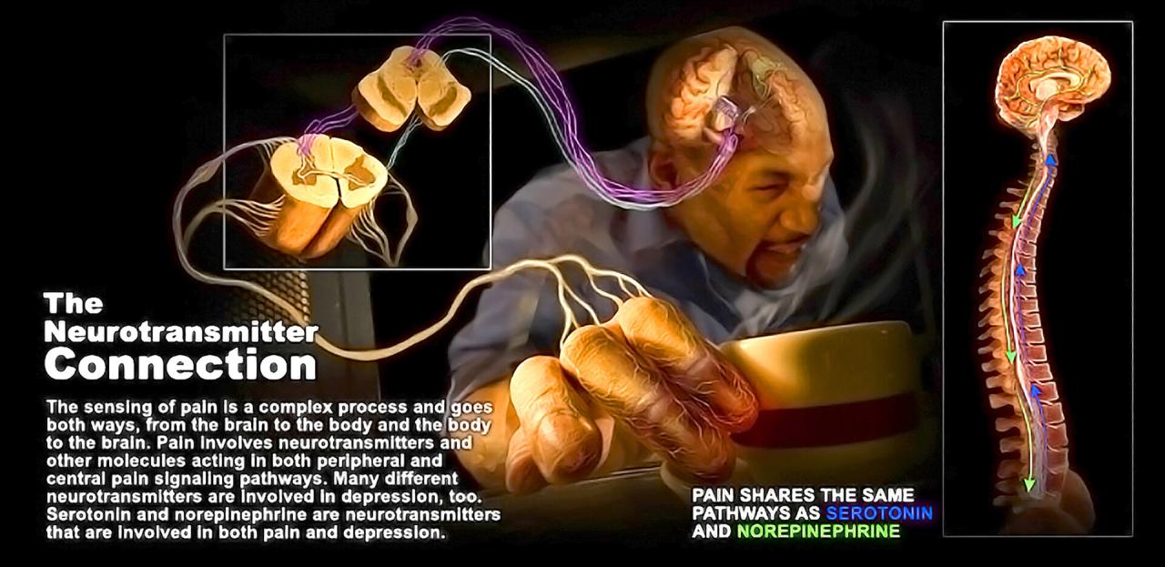 Pain relief central pain syndrome