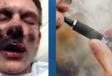 Concern growing over e cigarette explosions