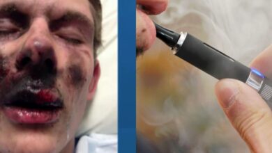 Concern growing over e cigarette explosions