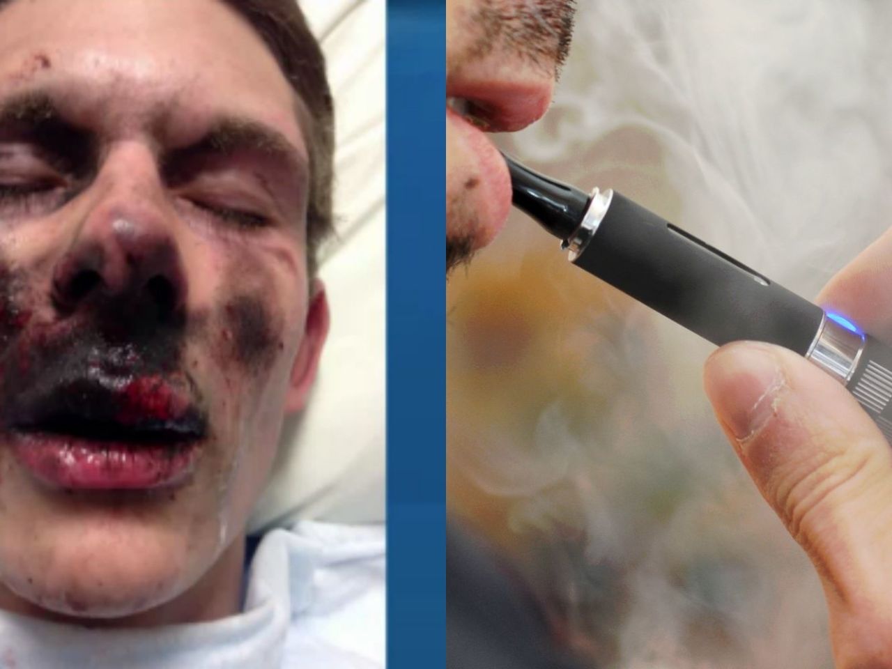 Concern growing over e cigarette explosions