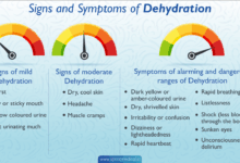 Here are the signs of travel dehydration you shouldnt ignore