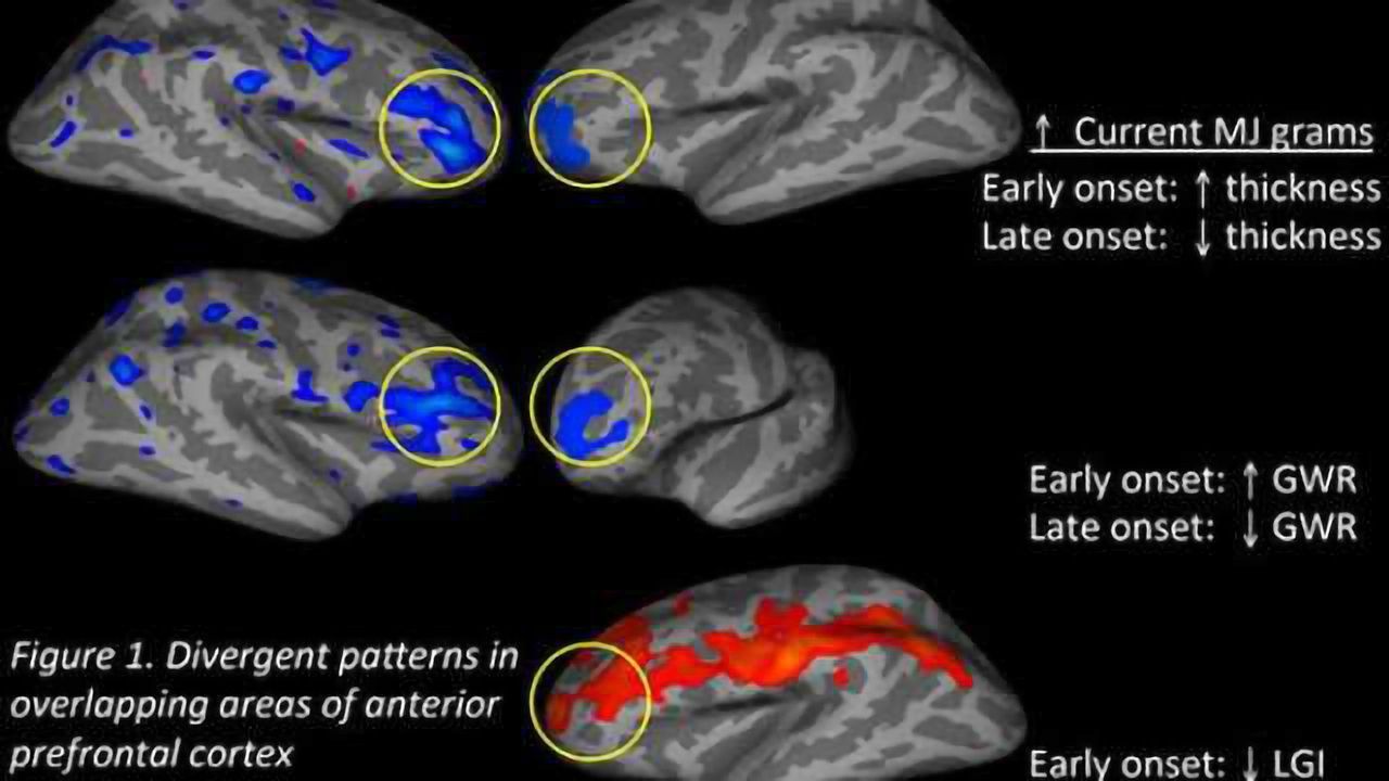 Brain cannabis accelerates ageing reveals major study christian graner john