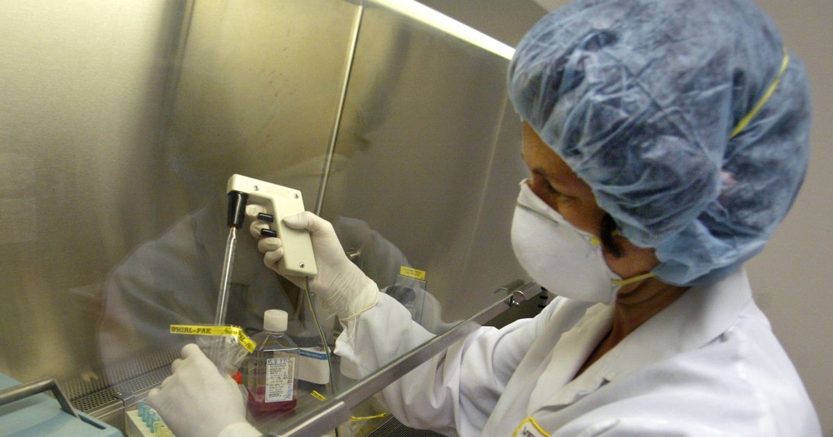 Second case of monkeypox reported in the us what to know