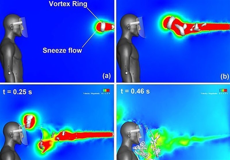 Why plastic face shields arent a safe alternative to cloth masks