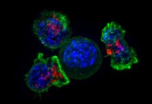 How does immunotherapy work melanoma