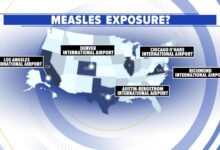 Travelers warned about contracting measles overseas