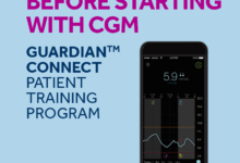 New medtronic stand alone cgm guardian connect