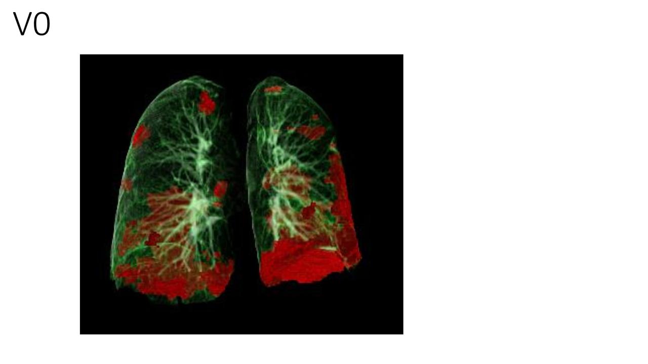 Long covid can cause heart problems along with breathing difficulties