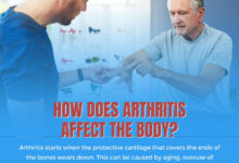 Arthritis higher risk depression