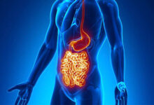 Cannabis improves symptoms of crohns disease