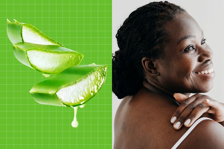 Qa for mpd does using aloe vera on skin inflammation help or hurt