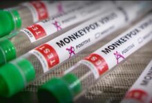 Can monkeypox survive on surfaces heres what we know