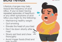 Ease heartburn without pills