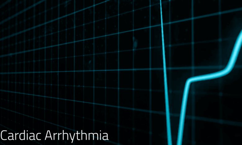 Arrhythmia electrical activity circular pattern
