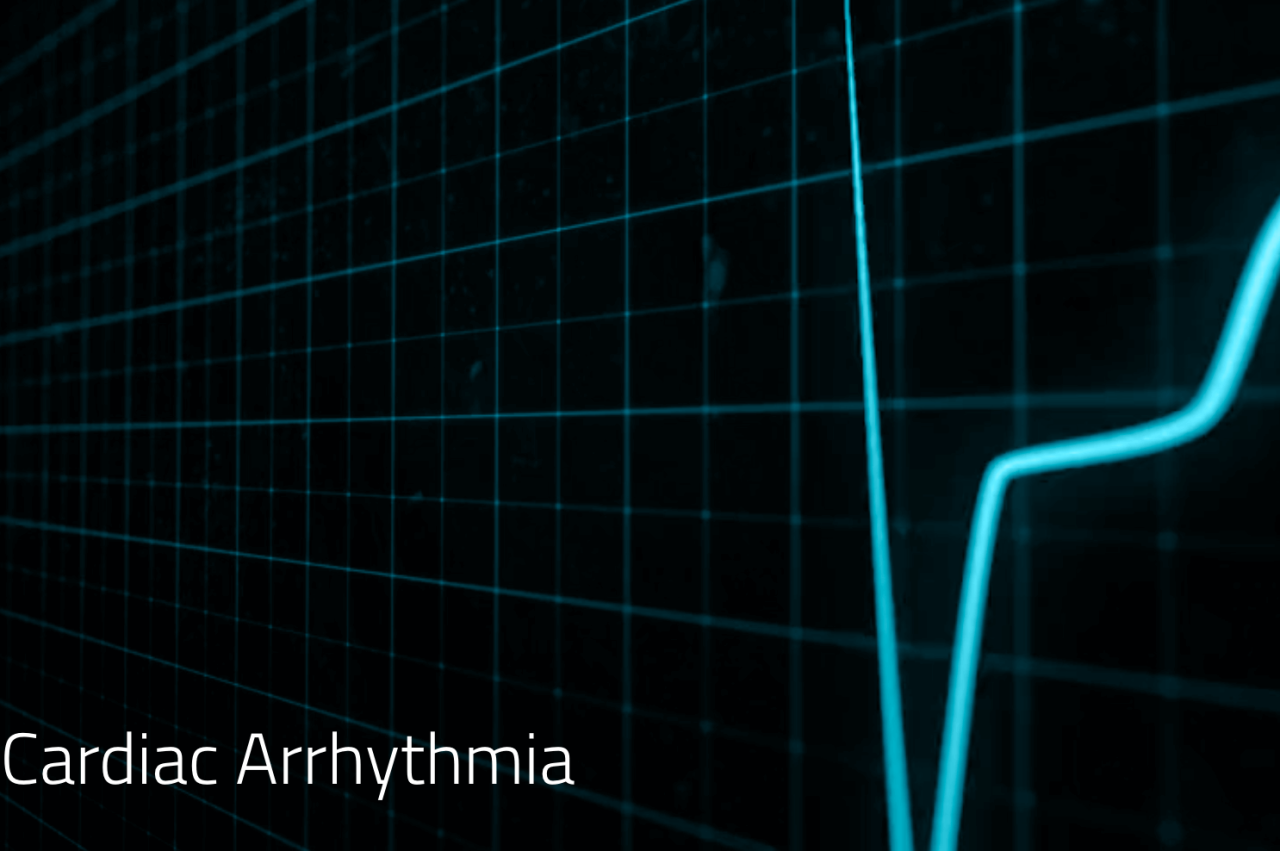 March 19th Question | Circulation: Arrhythmia and Electrophysiology Arrhythmia electrical activity circular pattern