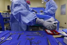 Simple surgery reduces stroke risk in people with heart arrhythmia