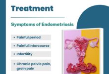 Endometriosis treatment diagnosis healthsoul