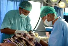 Interest in vasectomies increases after abortion ruling what to know about the procedure