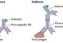 Sputum direct fluorescent antibody dfa