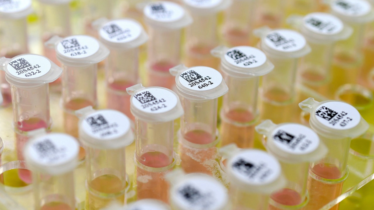 How long will it take to develop vaccine for coronavirus