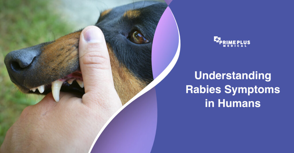 Can you treat rabies symptoms with rabies