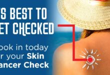 Topical immunotherapy reduces skin cancer risk