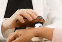 Skin cancer treatment laser treatments dermatologist removal nyc dermatology manhattan cosmetic top