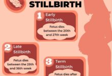 Stillbirth vs miscarriage how theyre similar and how theyre different