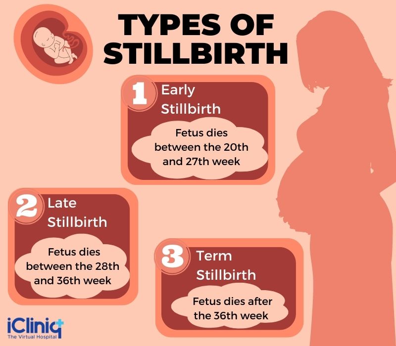 Stillbirth vs miscarriage how theyre similar and how theyre different