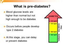 Normal blood sugar can hide prediabetes
