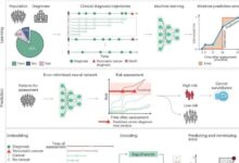 Pancreatic cancer new ai program could help with early detection