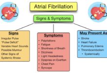 Link between asthma and atrial fibrillation