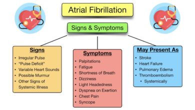Link between asthma and atrial fibrillation