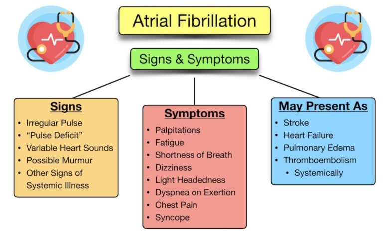 Link between asthma and atrial fibrillation