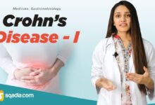 Fungi role in crohns disease
