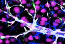 Researchers trying to pierce blood brain barrier for new alzheimers treatments