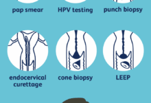 How do you know if you have cervical cancer