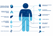 Obesity a cause and result of rheumatoid arthritis
