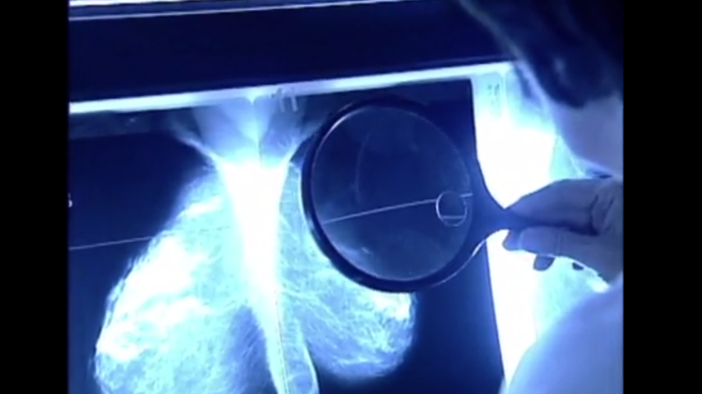 Is thermography a good way to detect breast cancer