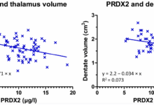 Oxidative stress affects multiple sclerosis